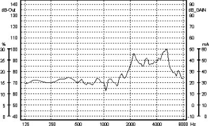 REUR obtenido mediante sonda microfónica a la presentación de un estímulo de 70 dB en un paciente adulto